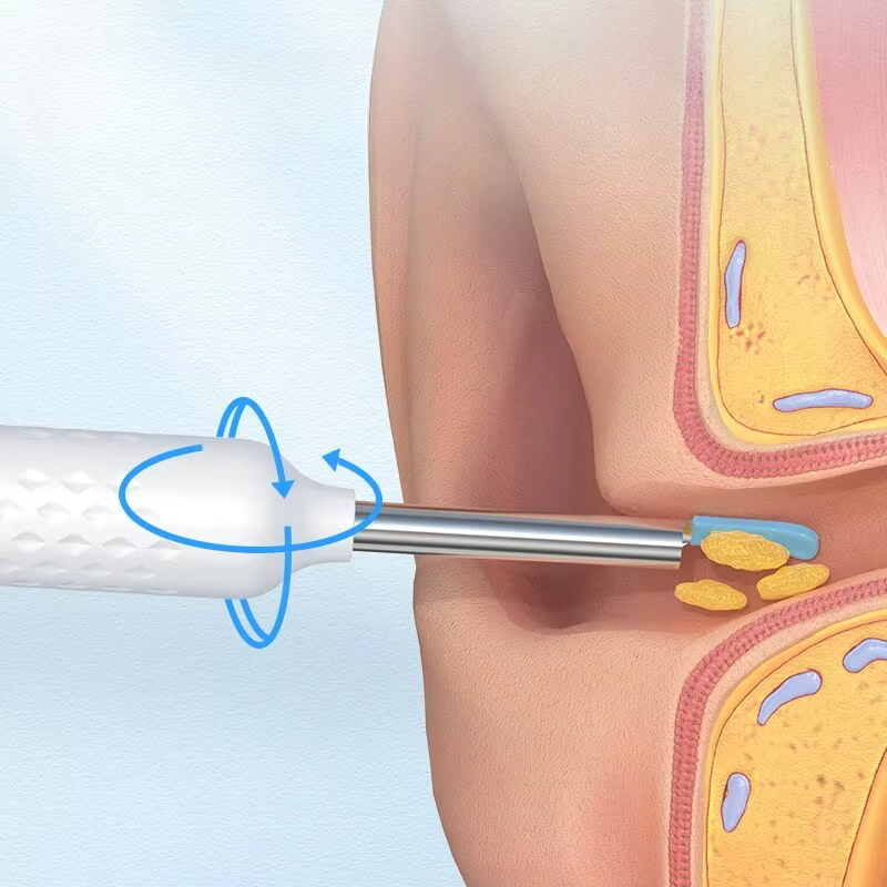 OptiClean - „Die nachhaltige Revolution der Ohrreinigung“